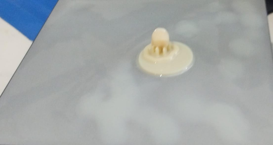 First denture printed at 3D Dental Lab of our hospital. To quote Neil Armstrong on first moon landing -"One small step, one giant leap for mankind"